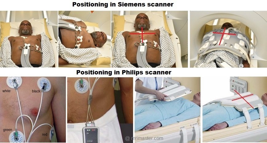 Cardiac (heart) MRI positioning