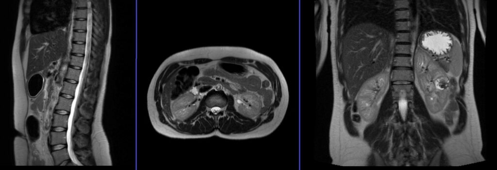 mra renal angiogram localiser image