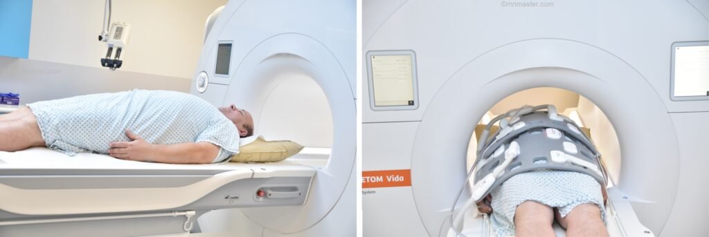MRI prostate positioning