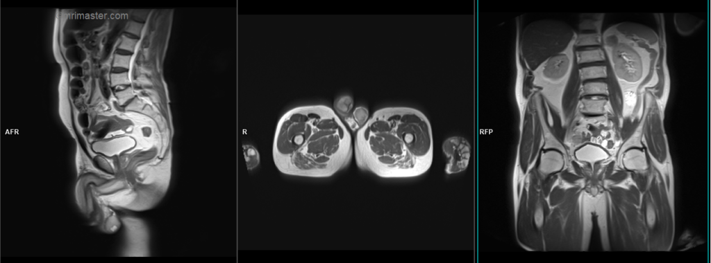 MRI testis protocol and planning localiser image