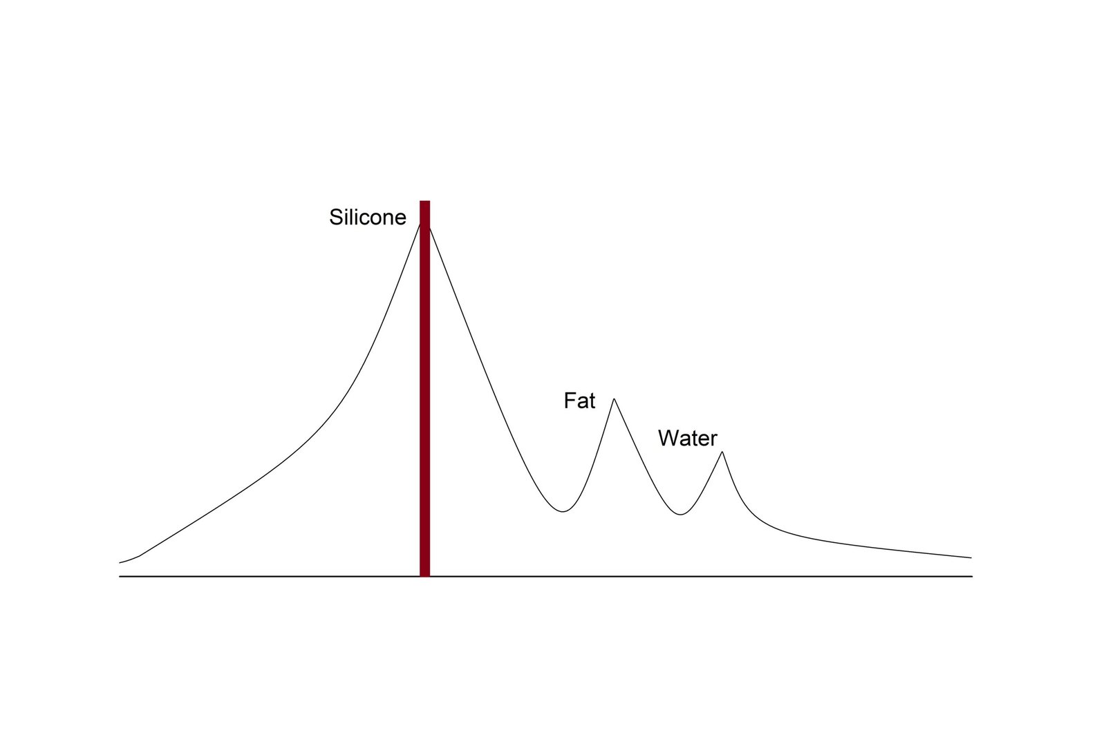 Breat Silicone Confirm Frequency adjestment graph MRI Breat Silicone Confirm Frequency adjestment graph MRI