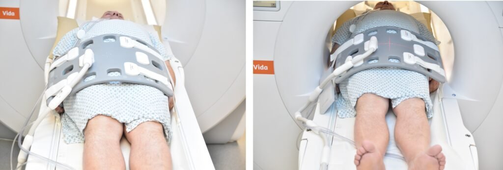 MRI rectal cancer positioning photo