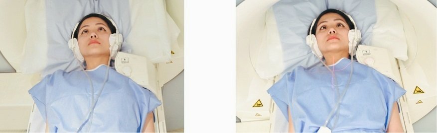 MRI shoulder positioning photo