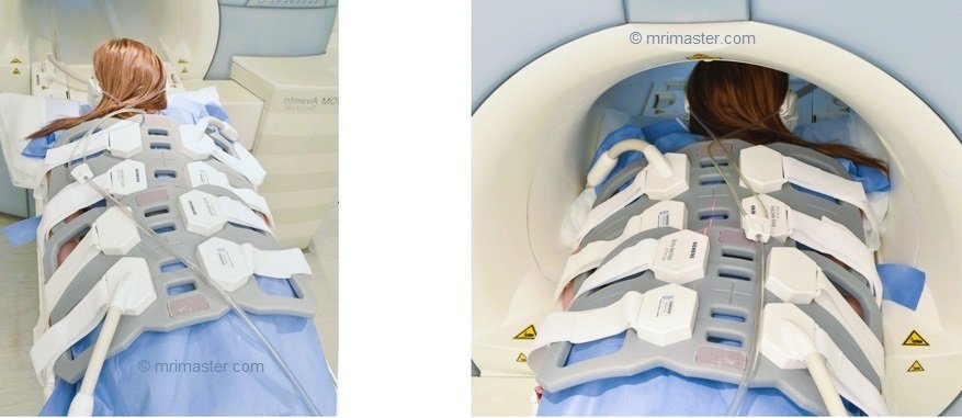 MRI small bowel positioning